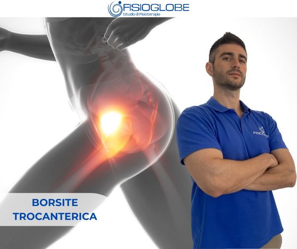 borsite trocanterica