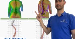 Spine 3D: strumento per l’analisi corretta della postura