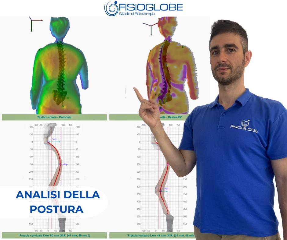 spine dorsali visibili tramite spine 3D